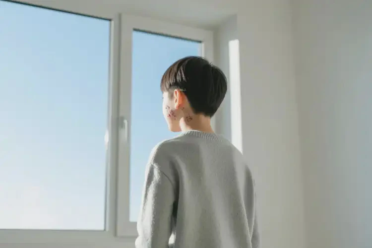 青年人全身起湿疹可以治好吗(图1)