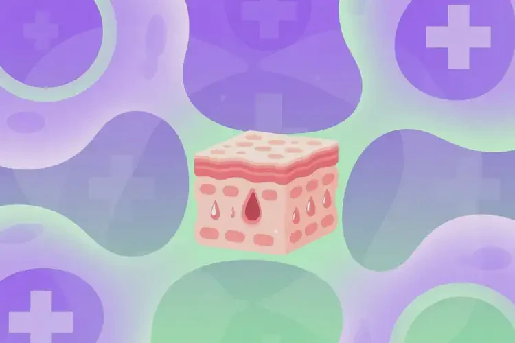 男生屁股偶爾起濕疹可不可以根治(圖1)