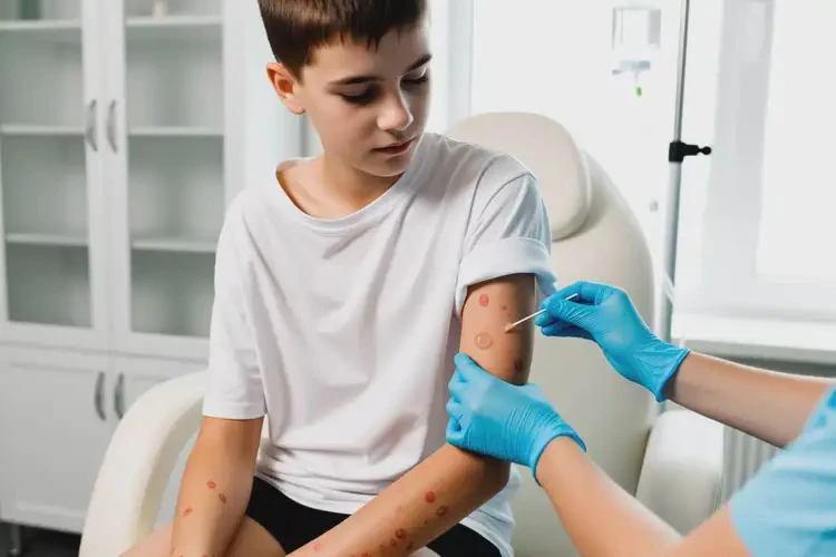 青少年四肢經(jīng)常長(zhǎng)濕疹可以治好嗎(圖4)