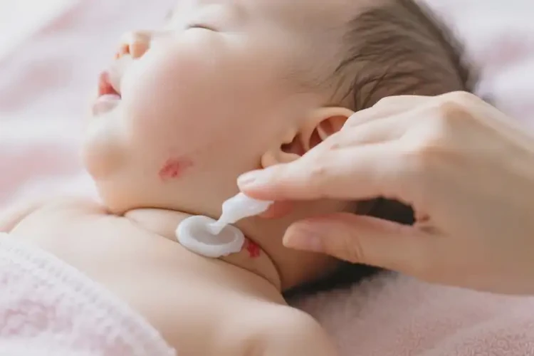 寶寶脖子起濕疹可以治好嗎(圖4)