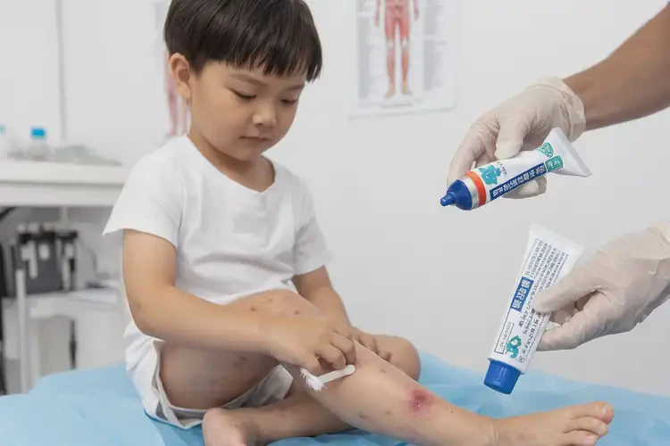 孩子小腿偶爾長(zhǎng)濕疹可以治好嗎(圖4)