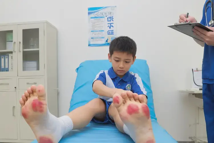 小學(xué)生腳上出現(xiàn)濕疹可以治好嗎(圖4)