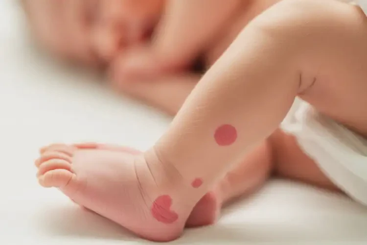 新生兒小腿上經(jīng)常長濕疹可以治好嗎(圖4)