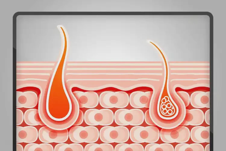 男生屁股偶爾起濕疹可不可以根治(圖2)