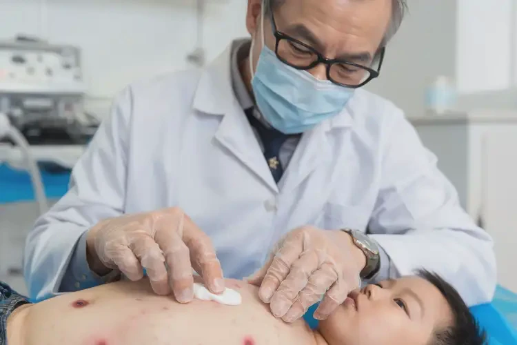 少兒肚子上經(jīng)常起濕疹可以治好嗎(圖3)