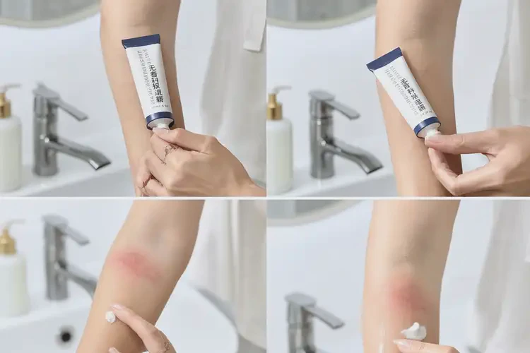 少兒面部經(jīng)常長濕疹可以治好嗎(圖3)