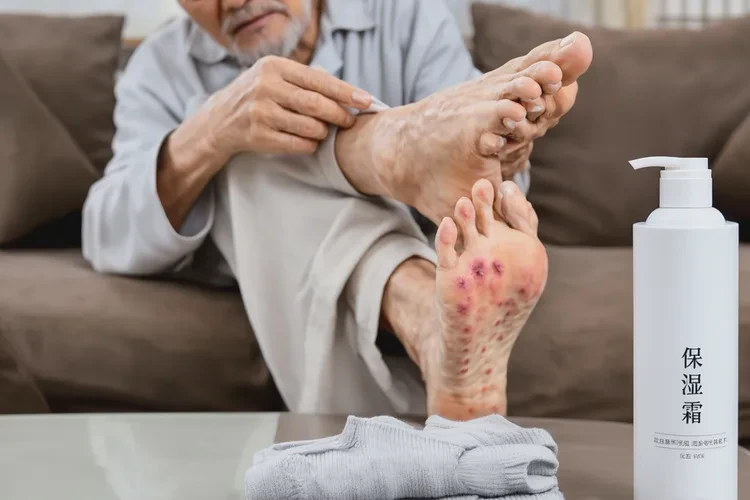 高齡老人腳上容易起濕疹能靠自己自愈嗎(圖1)