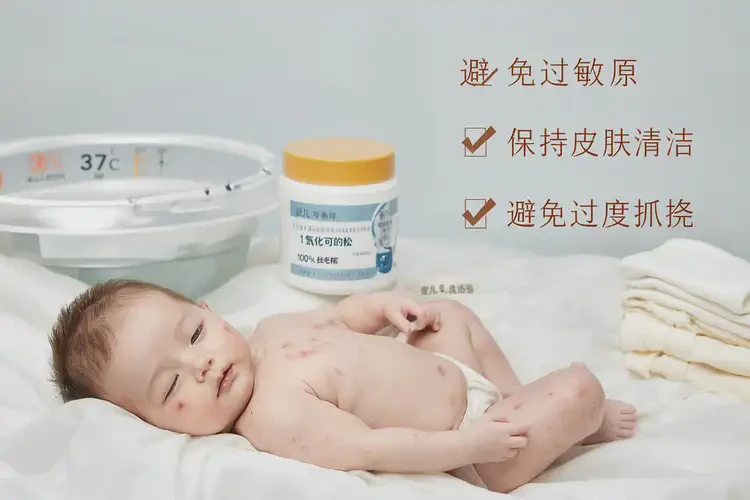 新生兒手臂上偶爾起濕疹可以治好嗎(圖3)