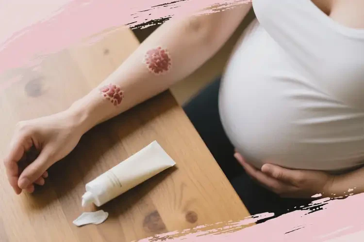 產(chǎn)婦手臂經(jīng)常長濕疹可以治好嗎(圖2)