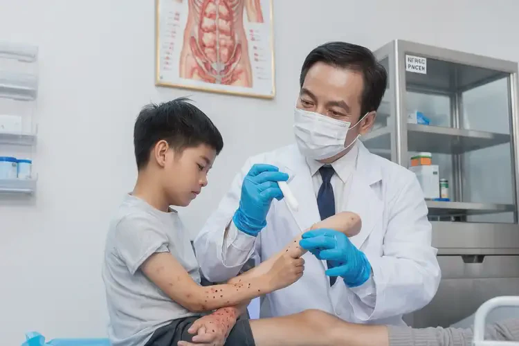 少兒四肢偶爾起濕疹可以治好嗎(圖3)