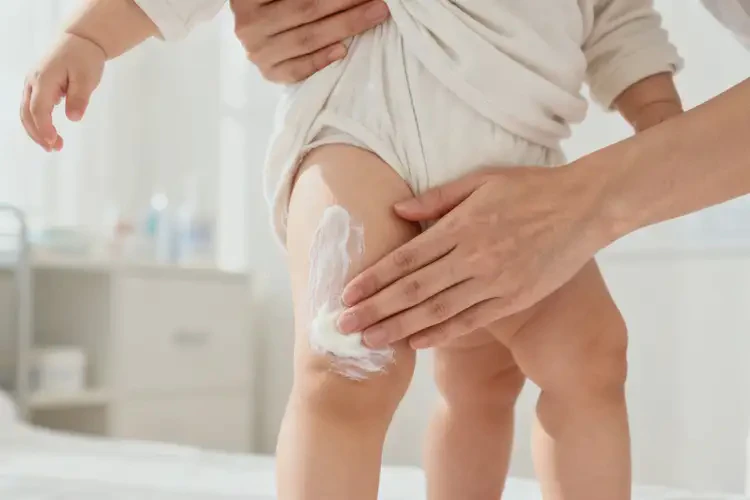 嬰幼兒大腿上經(jīng)常長濕疹可以治好嗎(圖3)