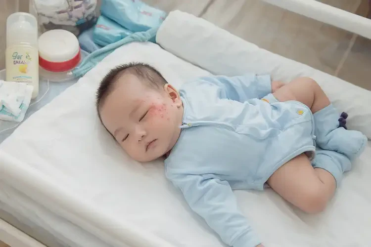 嬰幼兒脖子上出濕疹能徹底自愈嗎(圖2)