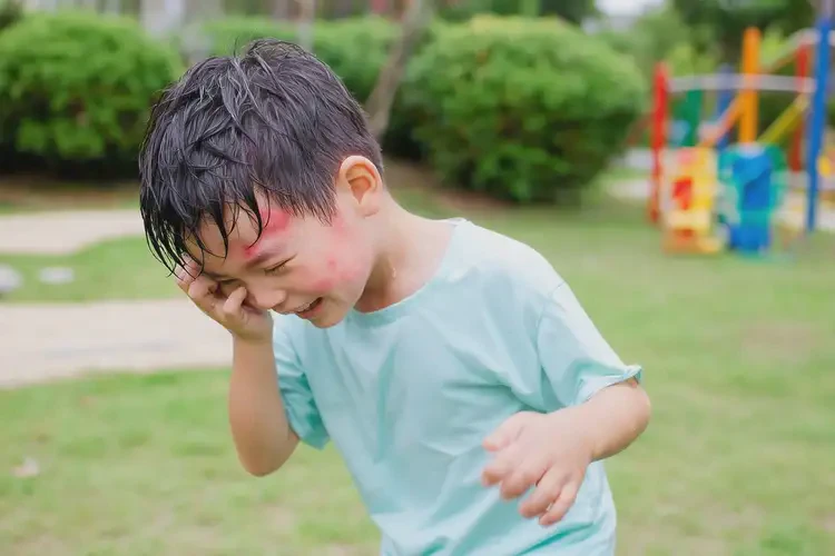 小孩脖子偶爾起濕疹能徹底自愈嗎(圖3)