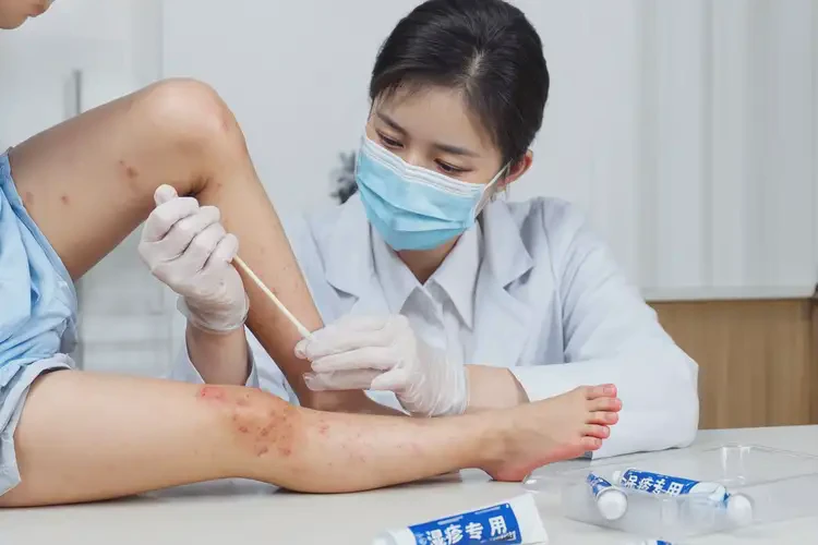 少兒小腿上起濕疹可以治好嗎(圖4)