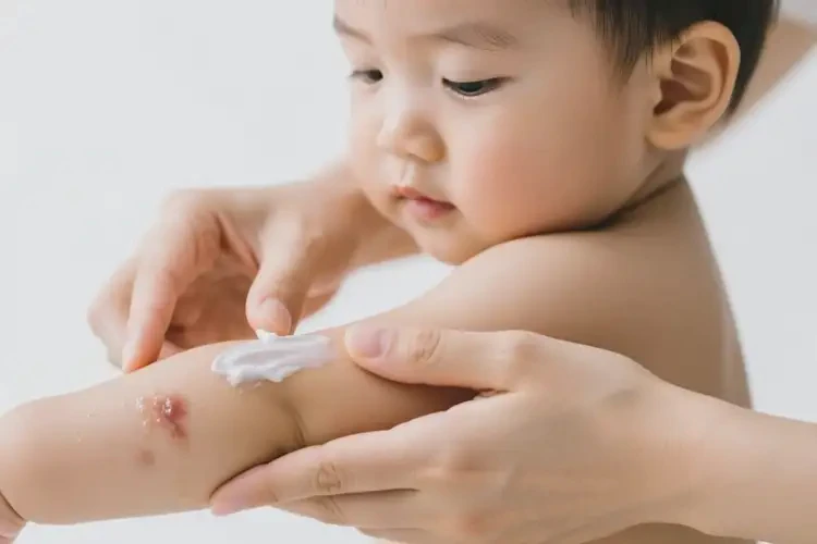幼兒手臂容易起濕疹可以治好嗎(圖1)