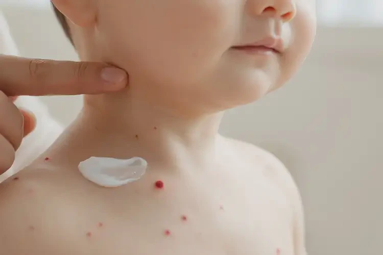 嬰兒脖子上起濕疹可以治好嗎(圖3)