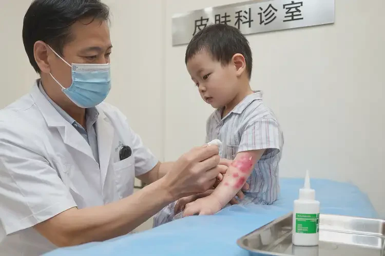 幼兒身上有濕疹可以徹底自愈嗎(圖3)