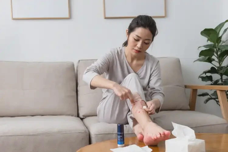 女人腳上偶爾長(zhǎng)濕疹可不可以根治(圖2)