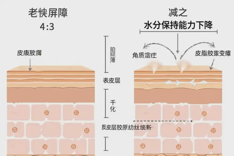老年人四肢容易长湿疹可不可以彻底自愈(图4)