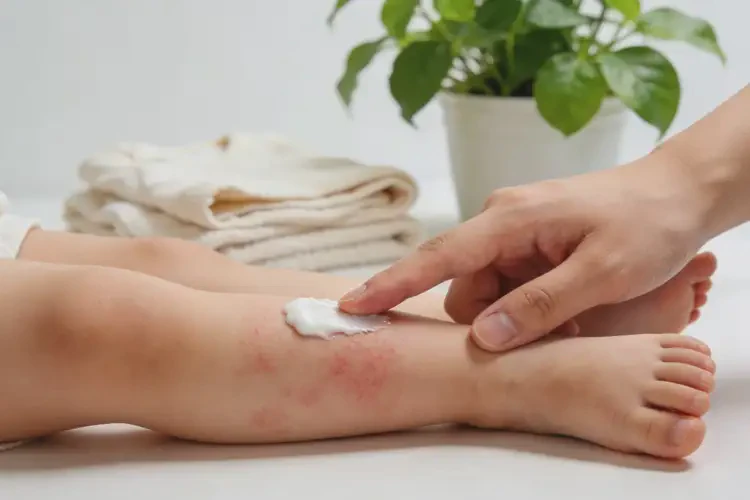 小孩四肢偶尔长湿疹可以治好吗(图4)