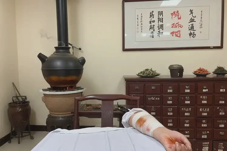 女性手臂上出現(xiàn)濕疹可以治好嗎(圖2)