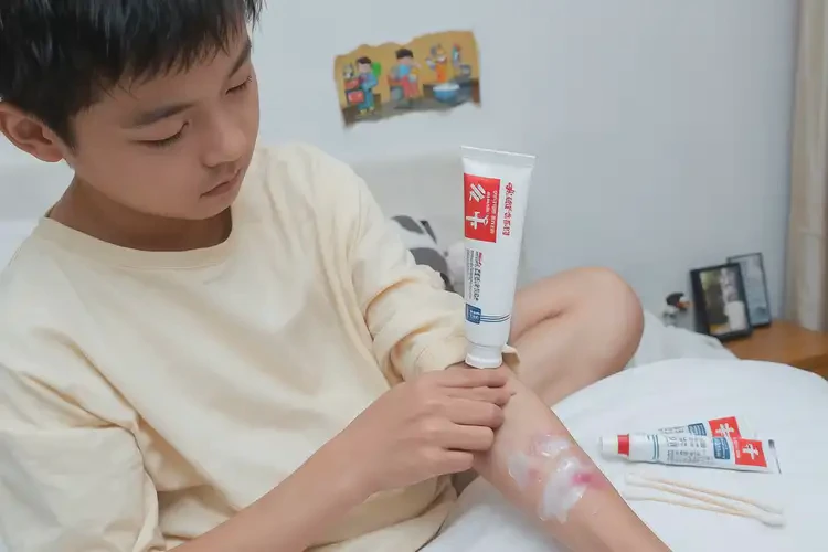 青少年四肢起濕疹可以治好嗎(圖4)