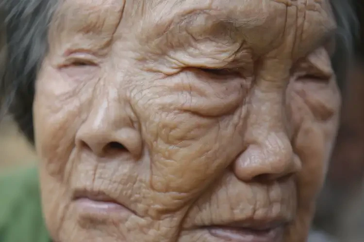 高龄老人脖子上经常长湿疹可不可以彻底自愈(图4)