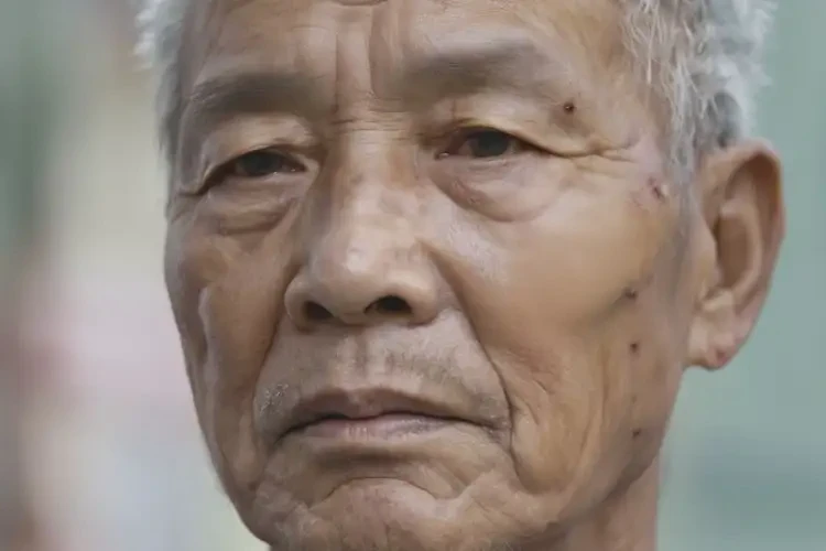 高齡老人面部容易起濕疹不管它會自己痊愈嗎(圖2)