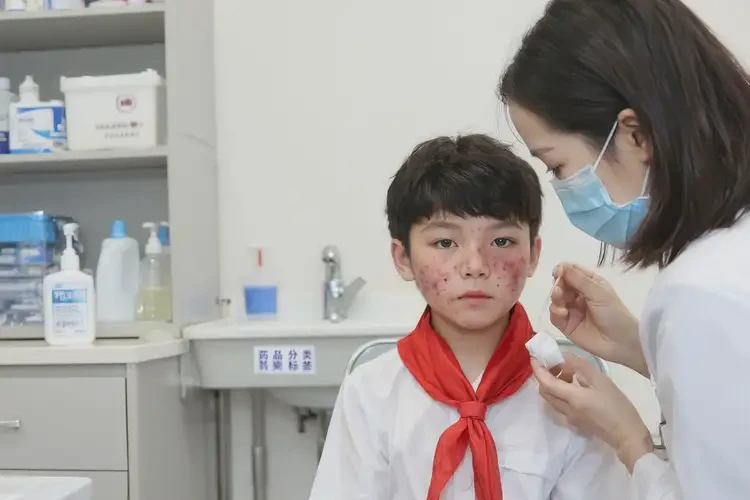 小學(xué)生臉上經(jīng)常起濕疹可以治好嗎(圖3)