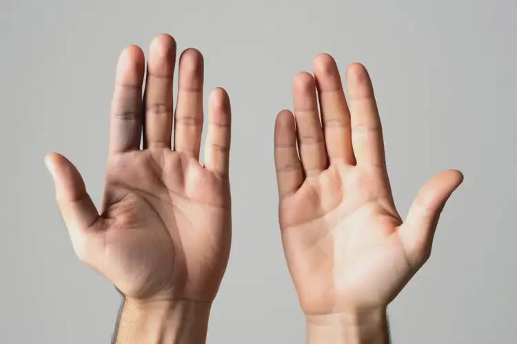 男性手上出濕疹可以治好嗎(圖2)