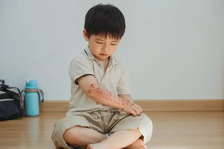 小學(xué)生全身出現(xiàn)濕疹可以治好嗎(圖3)