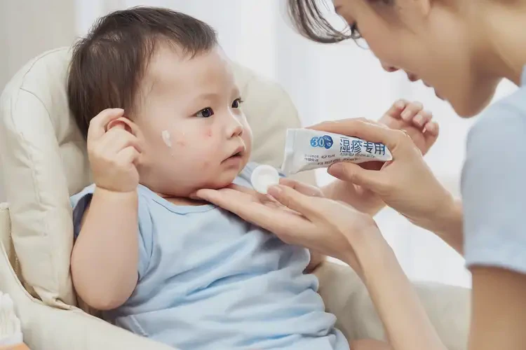 嬰幼兒面部容易起濕疹可以治好嗎(圖3)