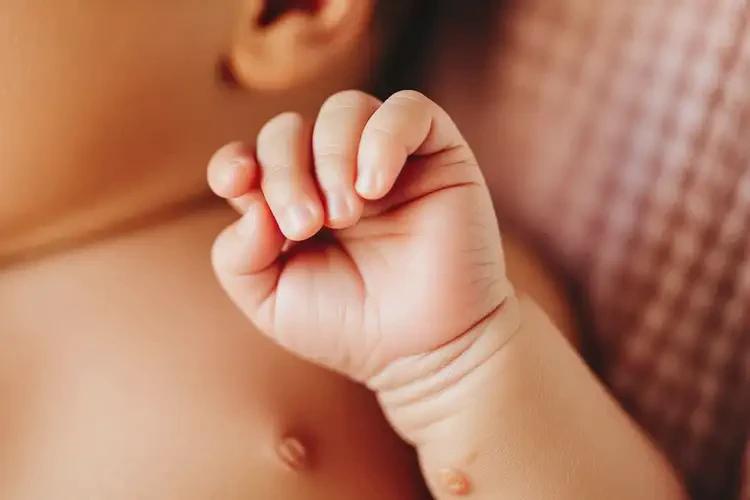 新生儿手臂经常长湿疹可以治好吗(图3)