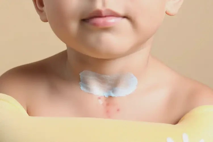 小学生脖子经常起湿疹可以治好吗(图3)