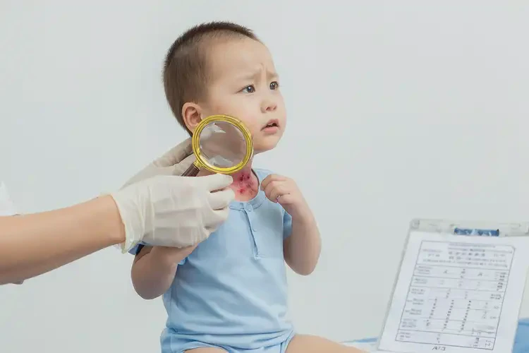 幼儿脖子偶尔长湿疹可以治好吗(图4)