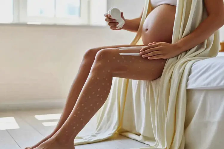 产妇四肢起湿疹可以治好吗(图3)