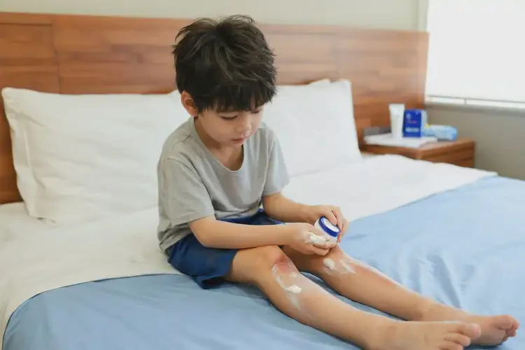 小兒大腿經(jīng)常長濕疹可以治好嗎(圖3)