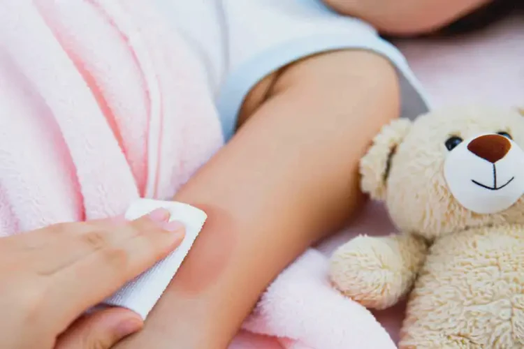 小學(xué)生手臂上偶爾長濕疹可以治好嗎(圖1)