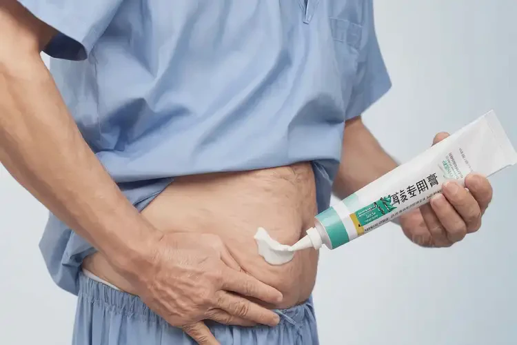大學(xué)生肛周出現(xiàn)濕疹可以治好嗎(圖3)