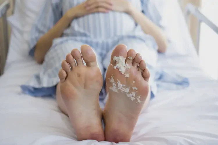 产妇脚上容易长湿疹能彻底自愈吗(图4)