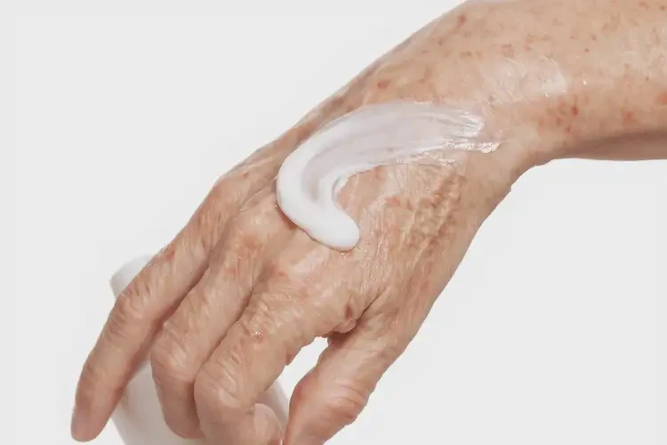 老年人手上經(jīng)常起濕疹可以治好嗎(圖3)