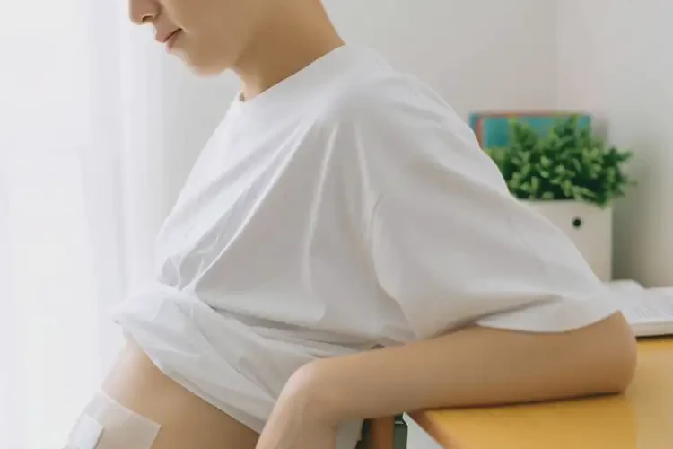 中學生肚子上經(jīng)常起濕疹可以治好嗎(圖4)