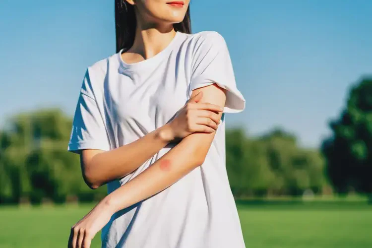 女生手臂上有濕疹可以治好嗎(圖2)