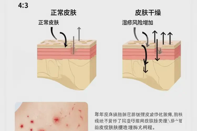 老年人腳上容易長濕疹能徹底自愈嗎(圖4)