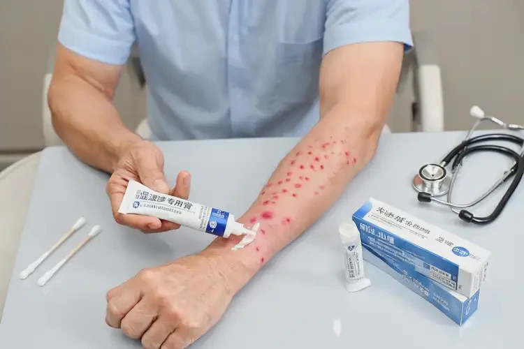 男性四肢經(jīng)常長濕疹可以治好嗎(圖3)