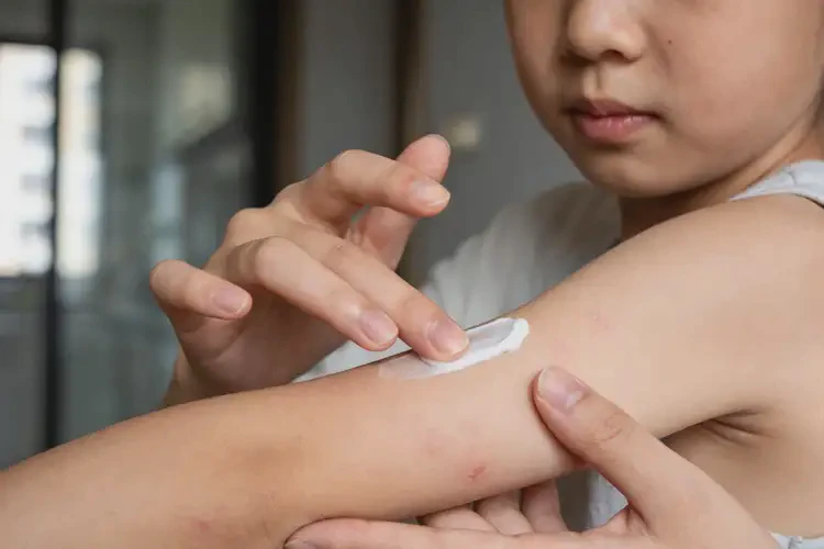 儿童手臂经常起湿疹可以治好吗(图3)