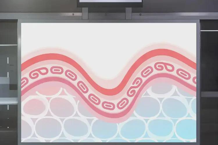 女性肛周經(jīng)常起濕疹可以治好嗎(圖4)