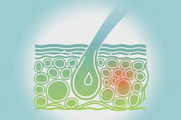 男人肛周容易長濕疹可以治好嗎(圖4)