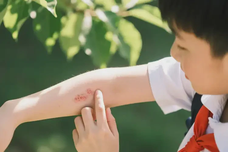 中学生手臂经常长湿疹可以治好吗(图4)