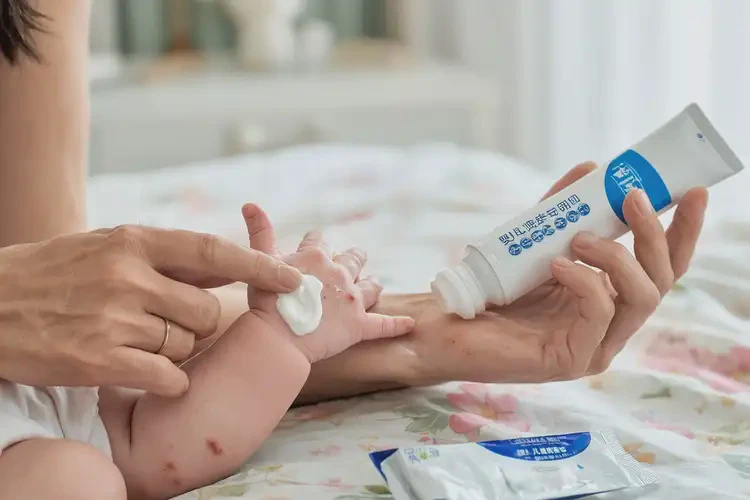嬰兒手上出濕疹可以治好嗎(圖3)